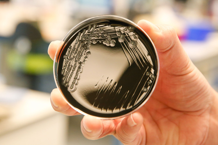News: 79 confirmed cases of Legionnaires’ disease now reported in outbreak linked to North Carolina state fair